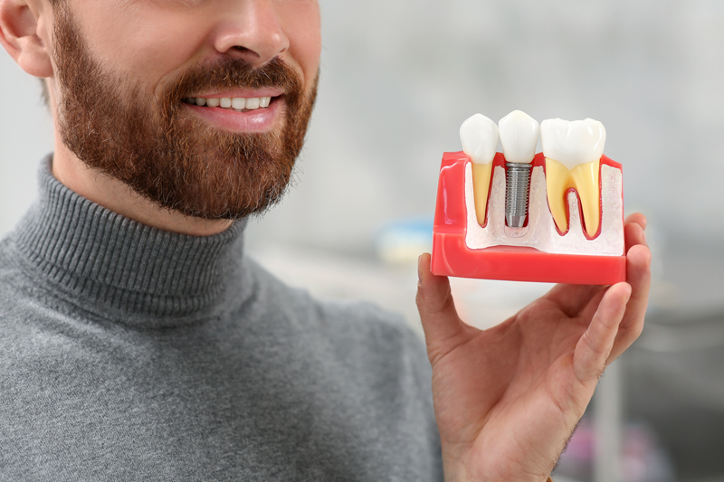 Understanding Dental Implants What Exactly Is The Abutment Harmon